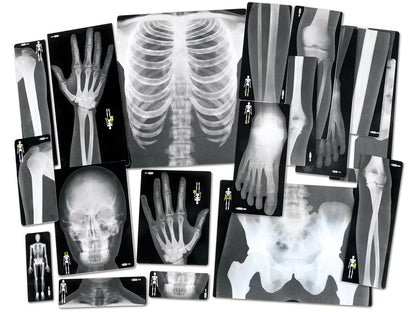 Human X-Rays - Set of 18 - US 1127