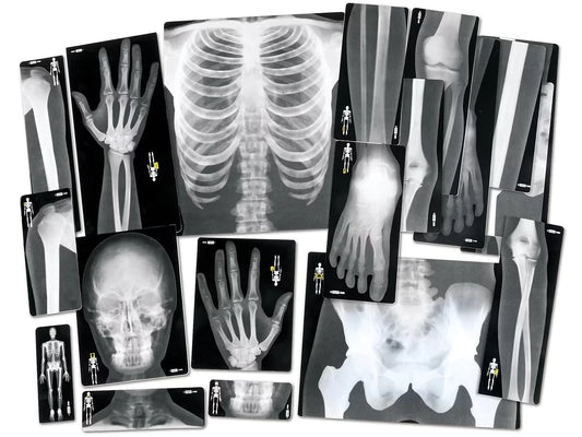 Human X-Rays - Set of 18 - US 1127