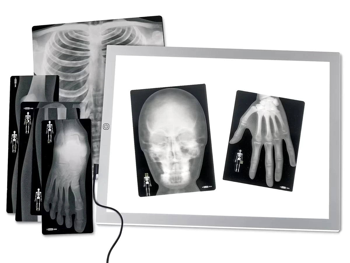 Human X-Rays - Set of 18 - US 1127